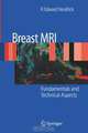 Breast MRI: Fundamentals and Technical Aspects, R. Edward Hendrick 