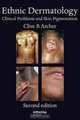 Ethnic Dermatology: Clinical Problems and Pigmented Skin, 