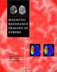 Magnetic Resonance Imaging in Stroke, 