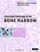 Illustrated Pathology of the Bone Marrow, Attilio Orazi, Dennis P. O