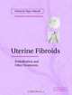 Uterine Fibroids : Embolization and other Treatments, 