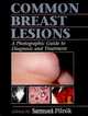 Common Breast Lesions : A Photographic Guide to Diagnosis and Treatment, 