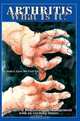 Arthritis what is it? : Decades of Diagnosis and Management with an exciting future, Ralph J. Argen MD FACP FACR 