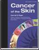 Cancer Of The Skin, 