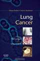 Lung Cancer: Dana-Farber Cancer Institute Handbook, 