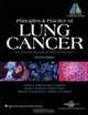 Principles and Practice of Lung Cancer: The Official Reference Text of the International Association for the Study of Lung Cancer (IASLC) (Pass, Lung Cancer), 
