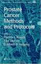 Prostate Cancermethods and Protocols (Methods in Molecular Medicine, 81), 