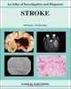 Stroke: An Atlas of Investigation and Diagnosis (Atlases of Investigation and Management), Marilyn M., M.D. Rymer, Isaac Edward Silverman 